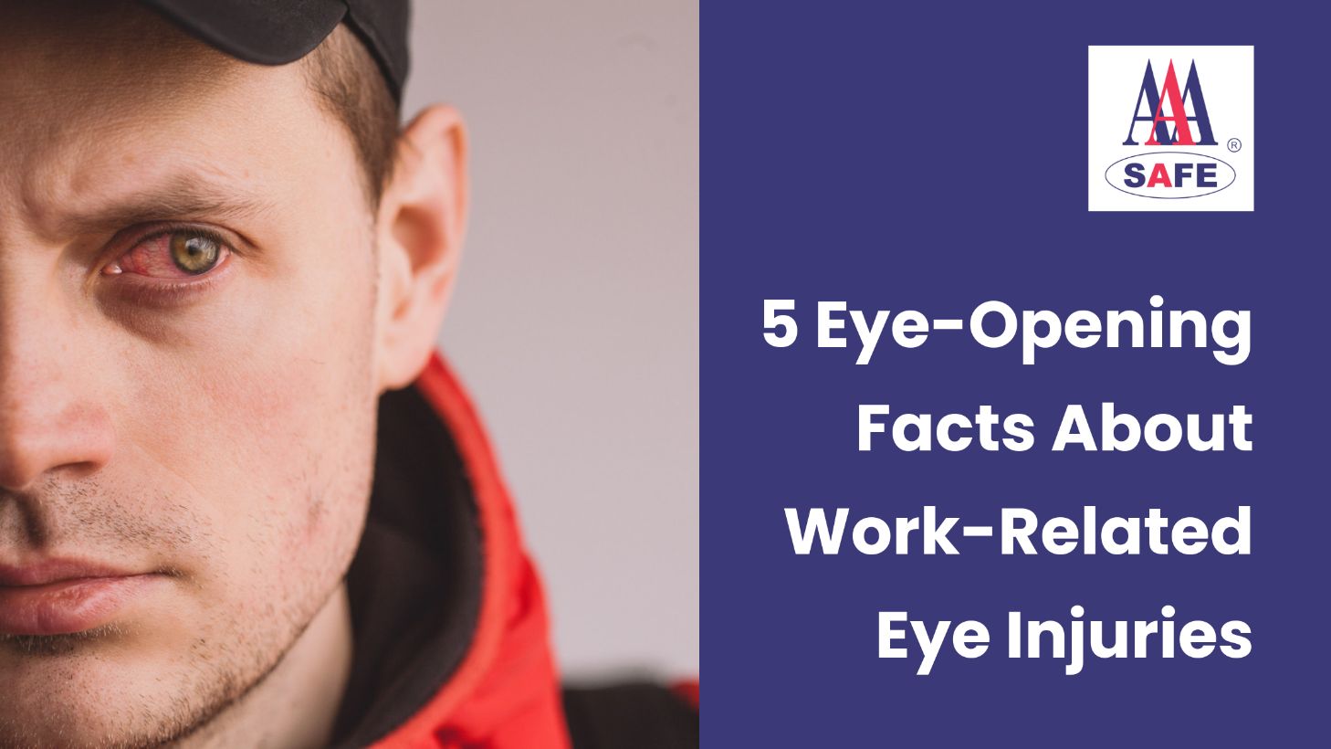 5 Eye-Opening Facts About Work-Related Eye Injuries You Need to Know